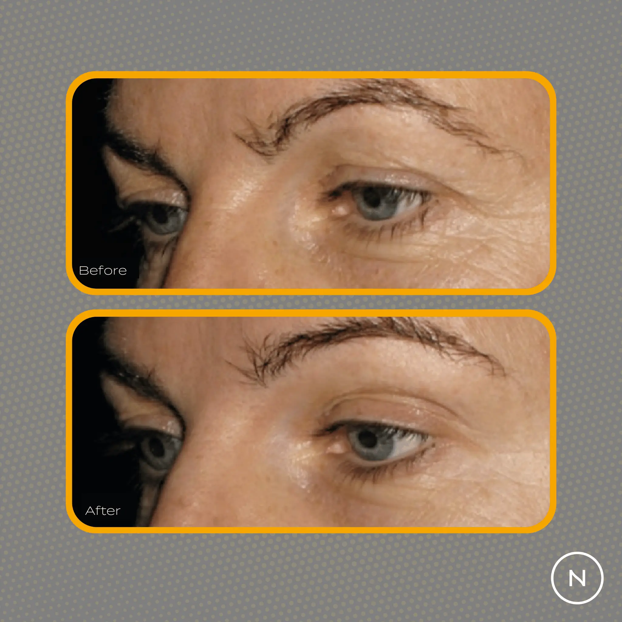 Collagen Peptides Powder - Image 4
